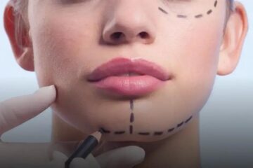 Harmonização Facial em Fortaleza: Transforme Sua Beleza