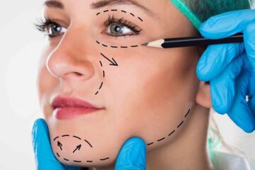 botox clima quente fortaleza; como manter resultados duradouros no verão