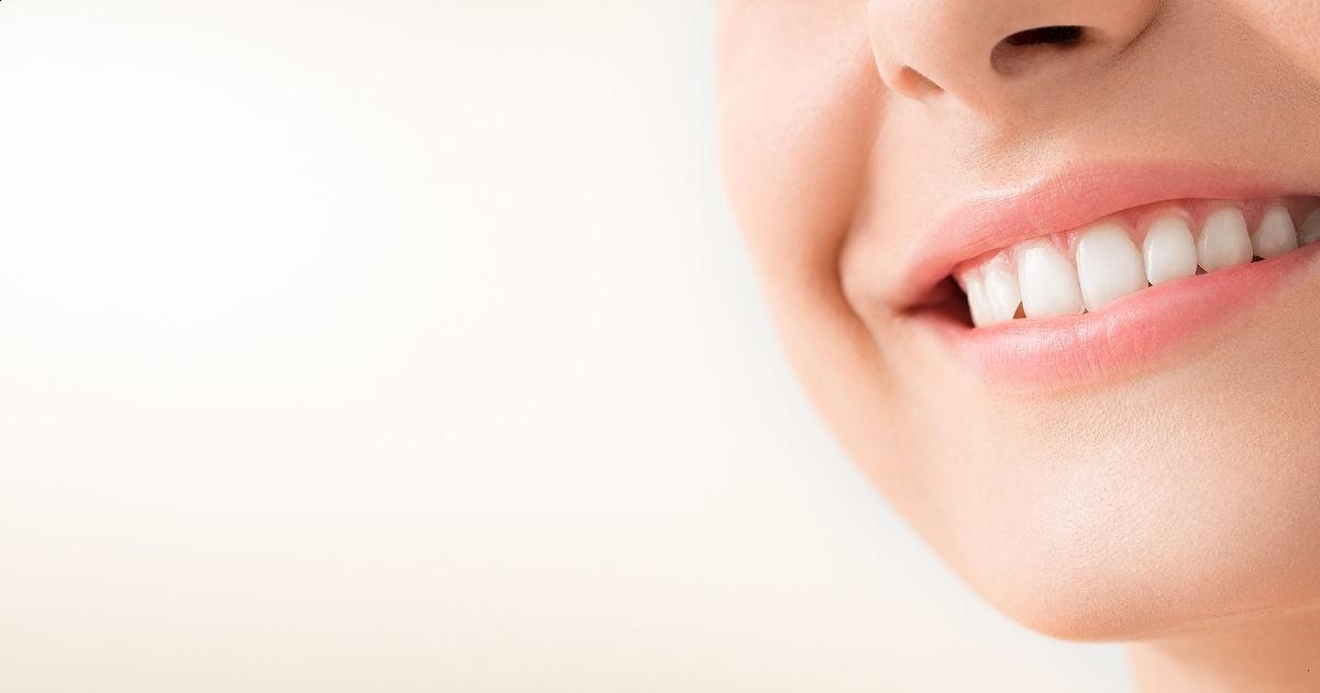 O que são lentes de contato dental e como funcionam