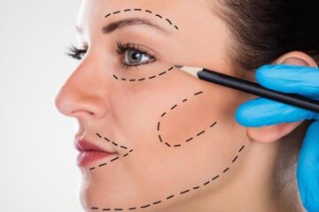 Preenchimento labial em Fortaleza: como aumentar os lábios com naturalidade;