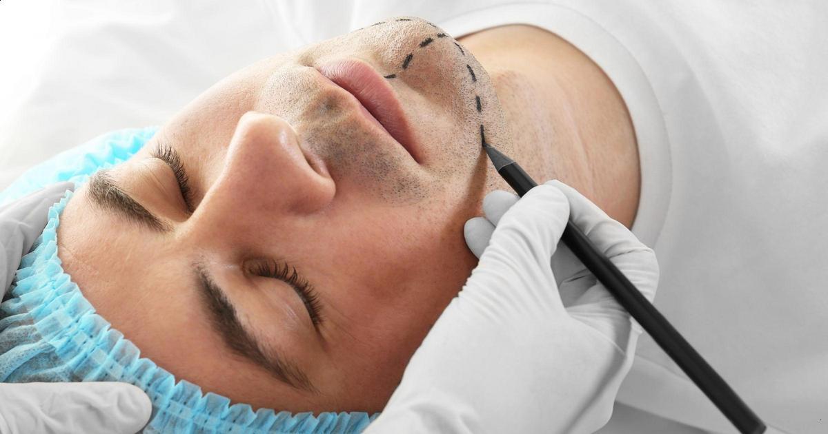 Quanto tempo dura o preenchimento labial