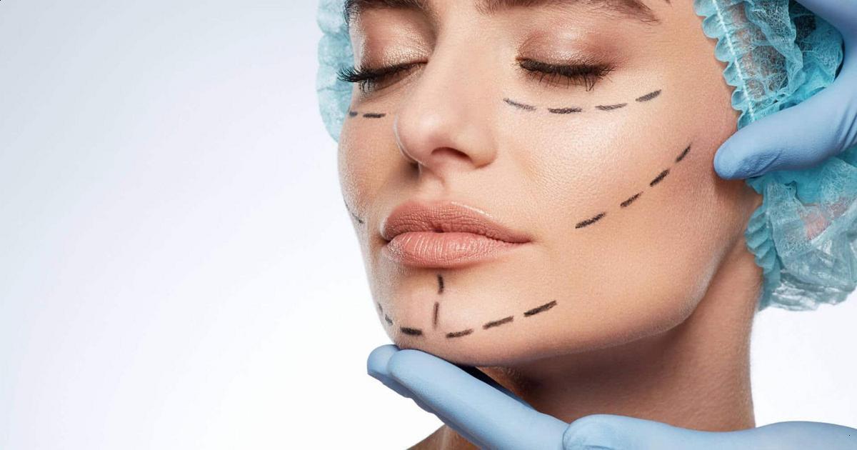 Resultados naturais e planejamento facial