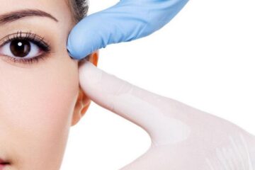 Baby Botox em Fortaleza: Por que os jovens estão começando a prevenir rugas aos 25 anos?
